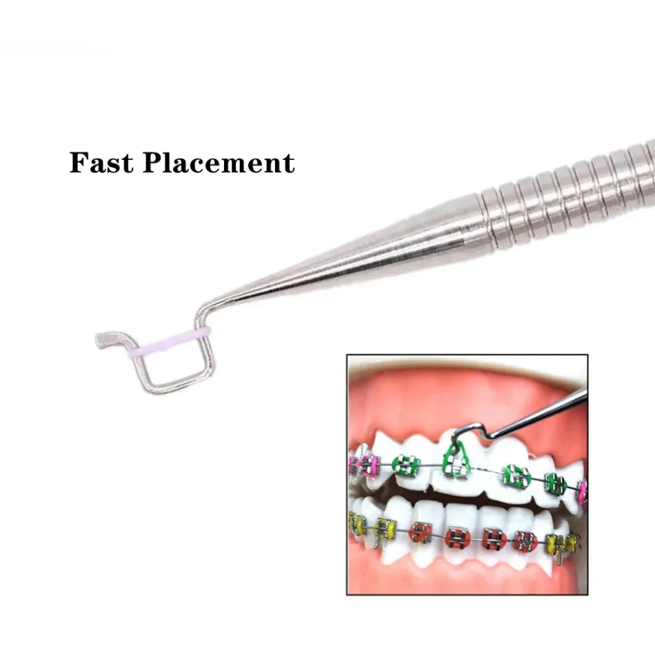 Dental Orthodontic Ligation Ring with Arch Wire Placer Stainless Steel Ligation Ring Divided Into Tooth Ring Ligation Molding