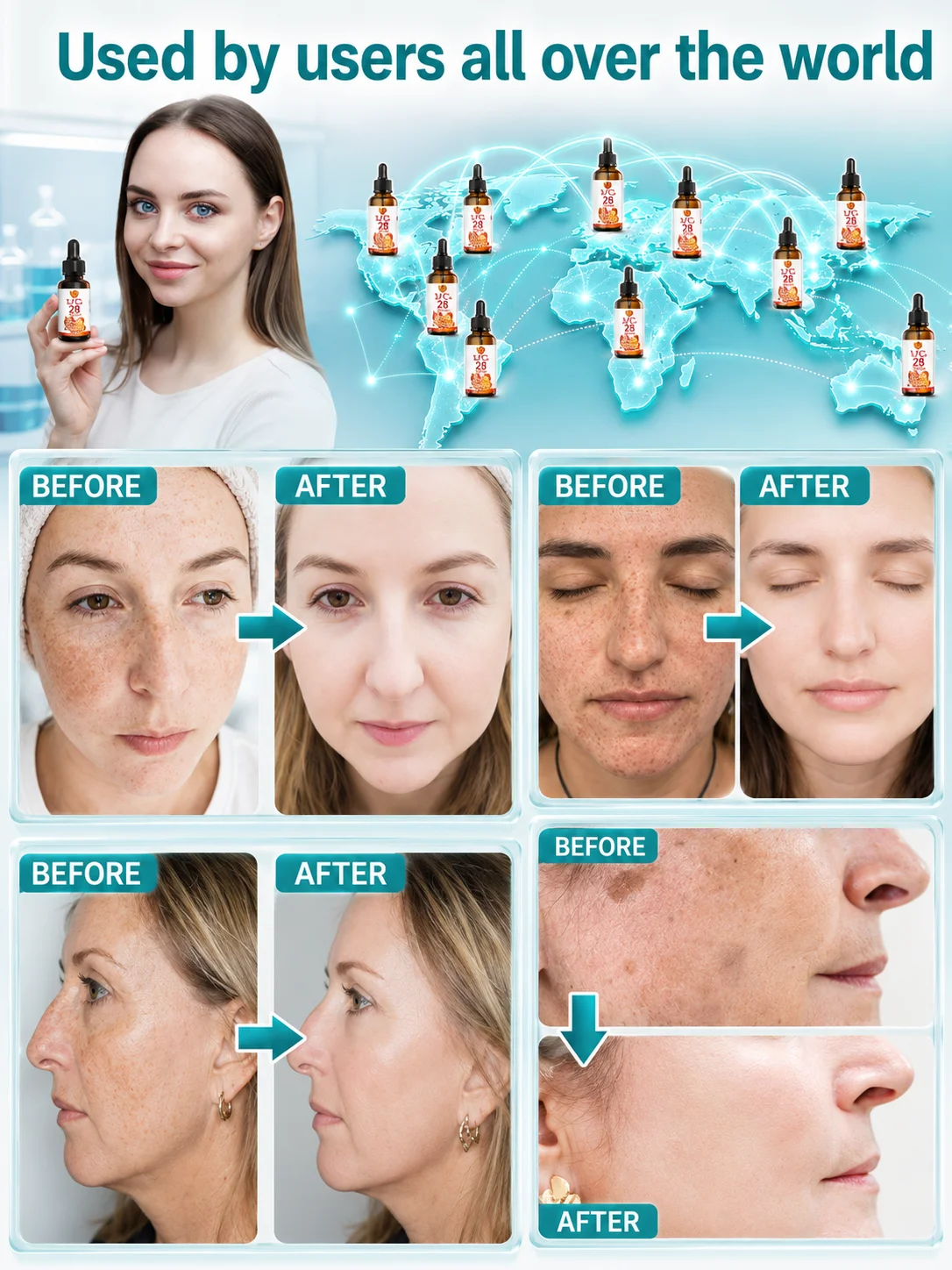 Dark Spots Removal Serum with Vitamin C, Facial Essence for Uneven Tone, Blemish Marks and Brighter-Looking Skin