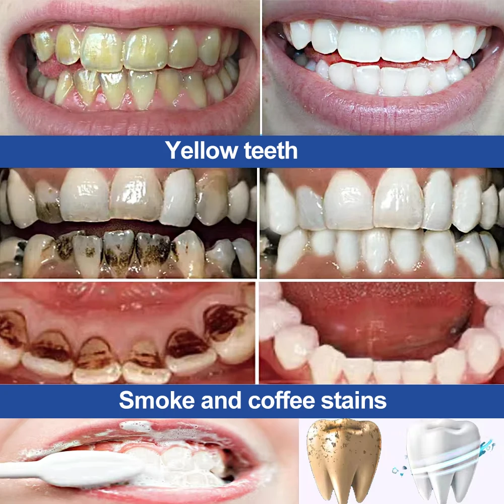 Teeth Whitening Tooth Powder Toothpaste Bleaching Remove Dental Plaque Stains Cleaning Oral Hygiene Fresh Bad Breath Tooth Care