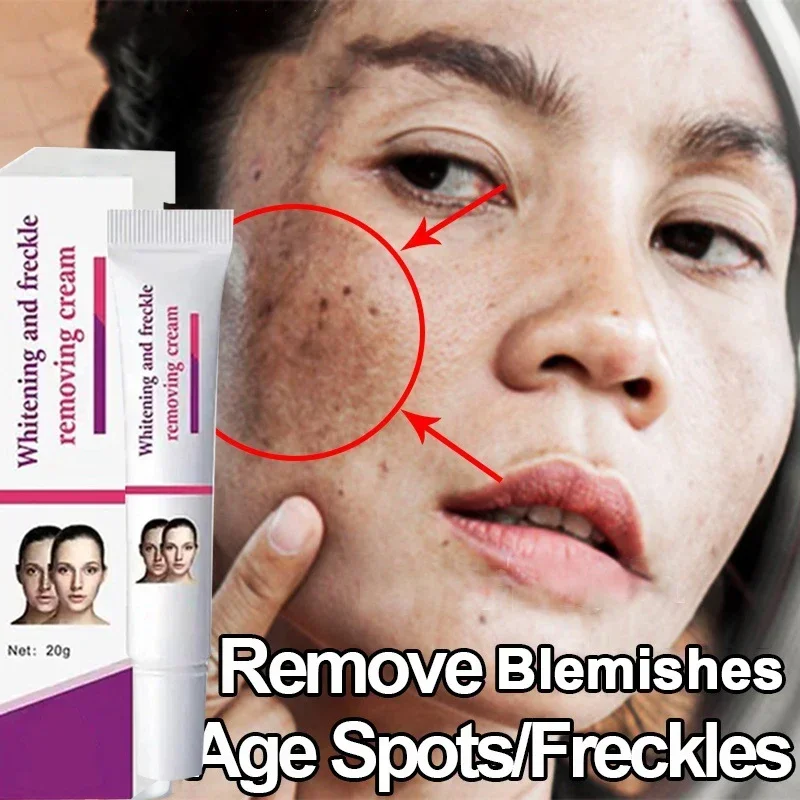 

Remove Dark Spots Whitening Freckle Remove Melasma Melanin Moisturize Brighten Smooth Face Skin Care