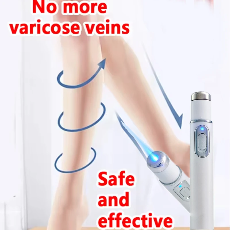 الوريد الليزر