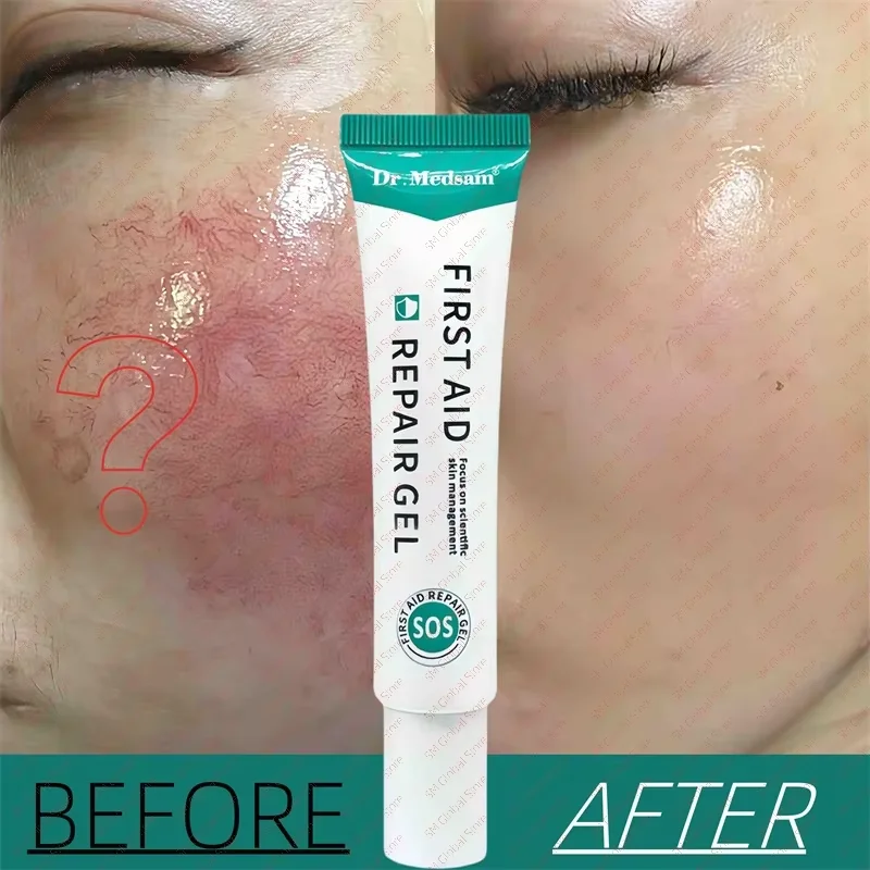 

Fast Repairing Redness Cream Facial Soothing Gel Calm Red Swollen Acne Dry Itchy Moisturizing Sensitive Skin Care Beauty Health