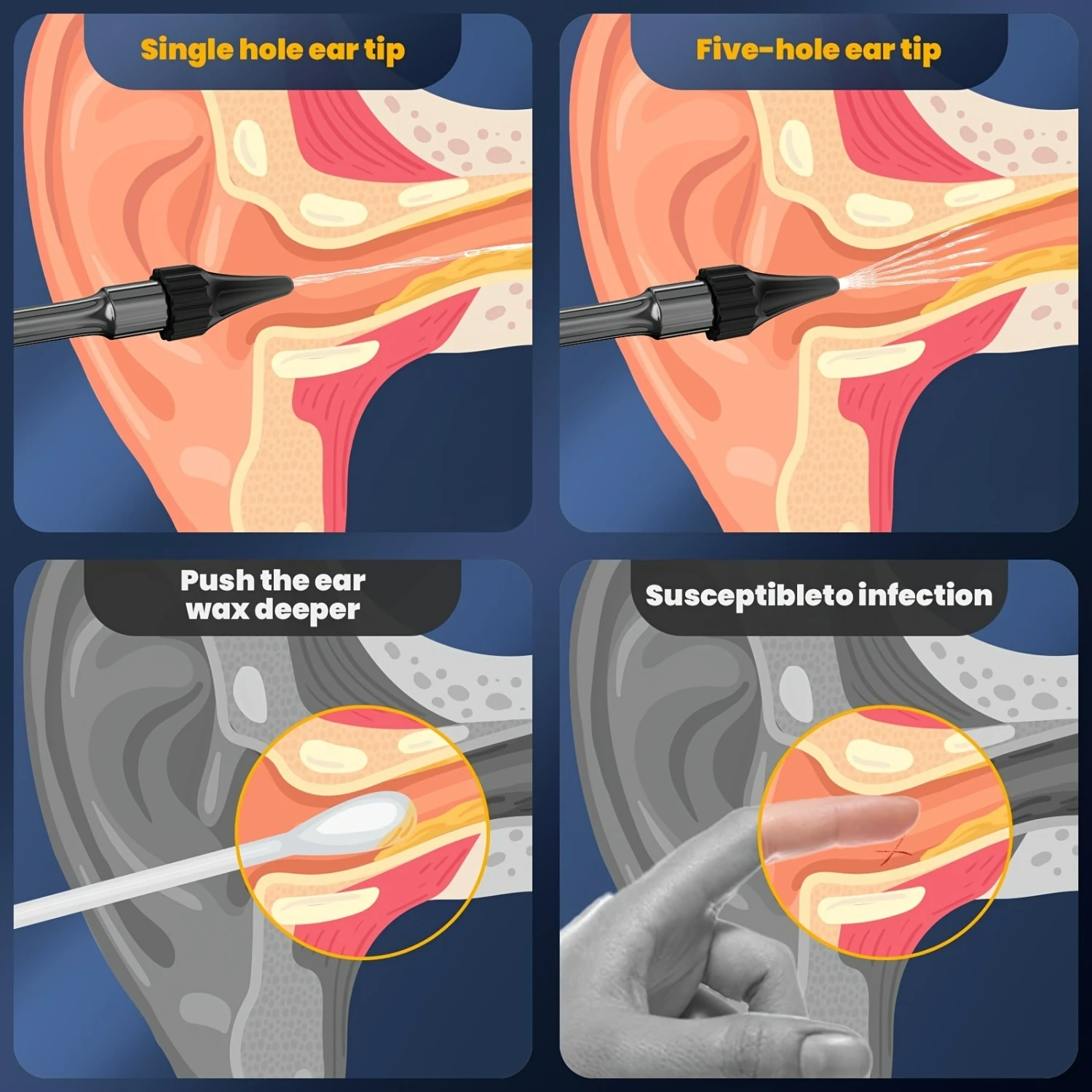 ชุดกําจัดขี้หูแบบพกพาน้ําหนักเบา - ระบบทําความสะอาดหูที่อ่อนโยนและมีประสิทธิภาพพร้อมโหมดแรงกด 4 โหมด - หู Irr ที่ขับเคลื่อนด้วยน้ํา