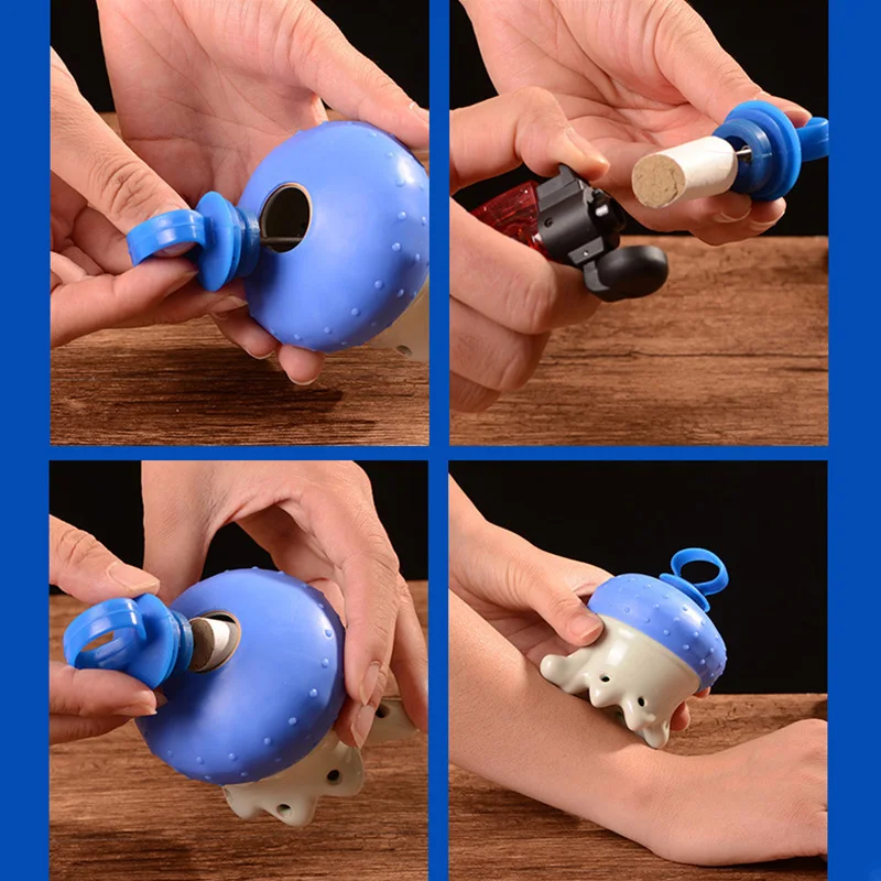 Head Moxibustion Moxa Therapy Warm Body Acupuncture Meridian Massage Relieve Headaches Promotes Sleep Health Care Ceramic Burner