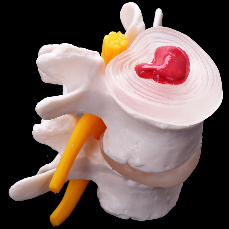 Esqueleto de coluna vertebral, Esqueleto de anatomia humana com 4 estágios, coluna vertebral lombar, modelo fonte de ensino de trauma