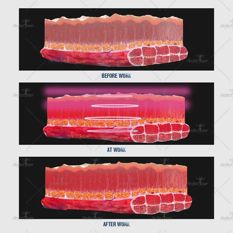 EMS Face Lifting Skin che stringe la macchina Anti-età viso sottile che dimagrisce il dispositivo di tonificazione muscolare del viso per la rimozione delle rughe indolore