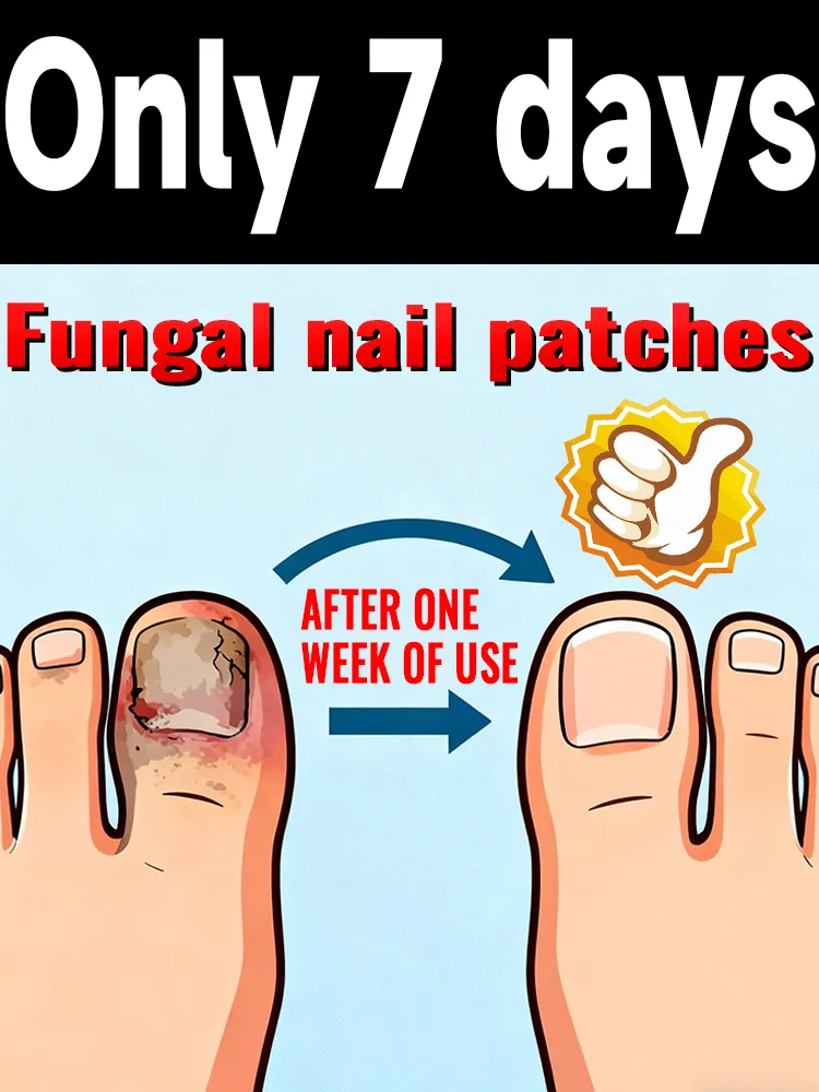 With consistent application, you'll see results and ʏᴏᴜʀ ᴏɴʏᴄʜᴏᴍʏᴄᴏsɪs ᴡɪʟʟ ɴᴇᴠᴇʀ ʀᴇᴄᴜʀ.