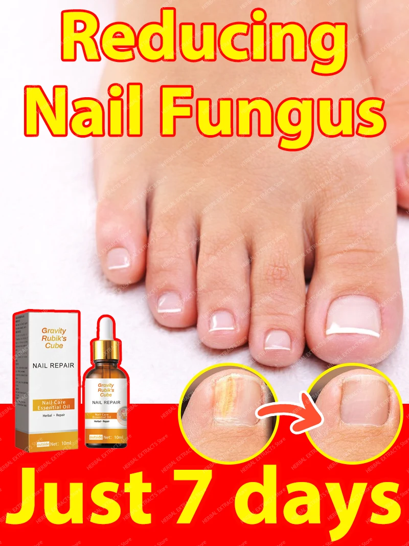 

Decrease in nail fungus on hands and feet