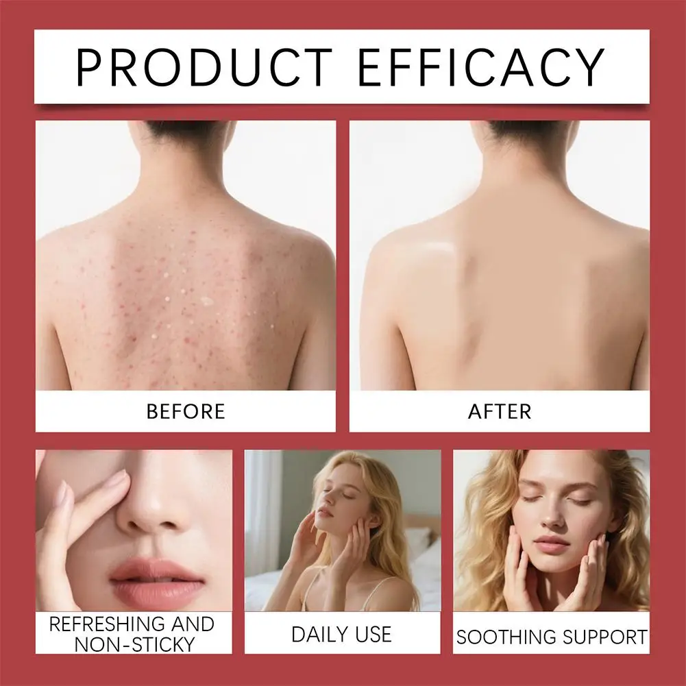 

Strawberry Renewal Cream Rejuvenation Vitamin E for Skin Renewal Deep Nourish Smooth Skin Firming Tightening Cream