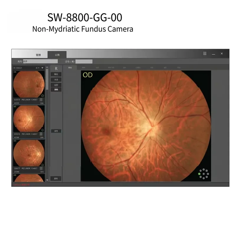 Hot Sale SW-8800 Non-Mydriatic Fundus Camera,45° Wide Field Retinal Camera with Multi-Image Processing for Eye Hospital