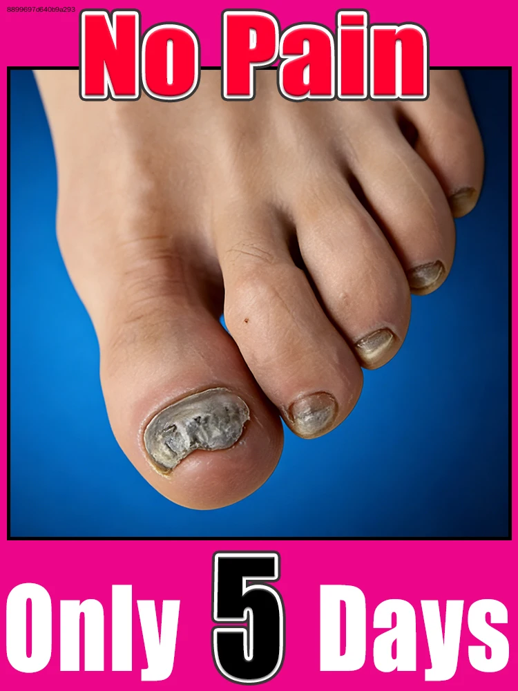 

2026 NEW Nail Cleaning Brush Manicure Tool Hot Sale Foot Care Nail Art Accessory