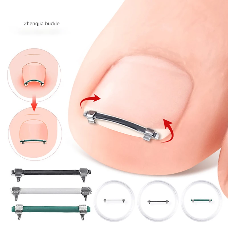 Herramienta de pedicura para uñas encarnadas, cuidado de las uñas del dedo del pie, Clip de corrección alisador, abrazadera curva, herramienta de corrección de uñas de los pies