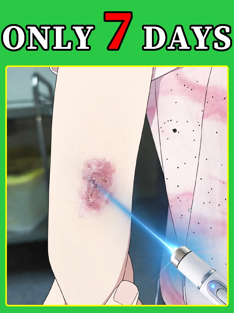 Hot-selling littekenverzorgingstool om de huid snel te herstellen tot de gezondheid.