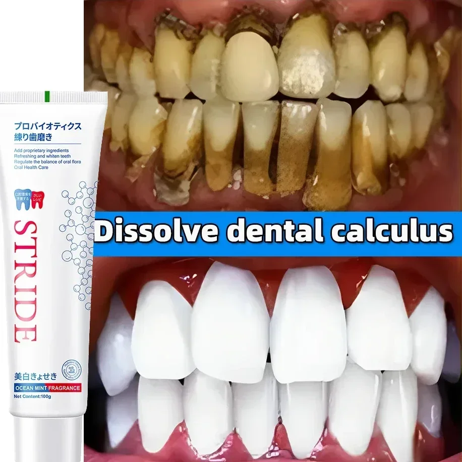 

Sdotter New Teeth Whitening Toothpaste Remove Plaque Stain Dental Calculus Fresh Breath Preventing Periodontitis Oral Cleaning C