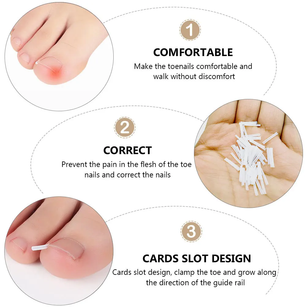 

60Pcs Ingrown Toenail Correction Patches Curved Toenails Strips Professional Pedicure Corrector for Nail Health