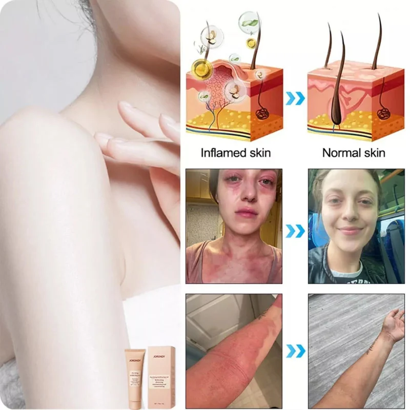 

Moisturizing Exfoliating Repair Essence with Hydration Sloughs Dead Cells, Provides Hydration and Enhances Repair