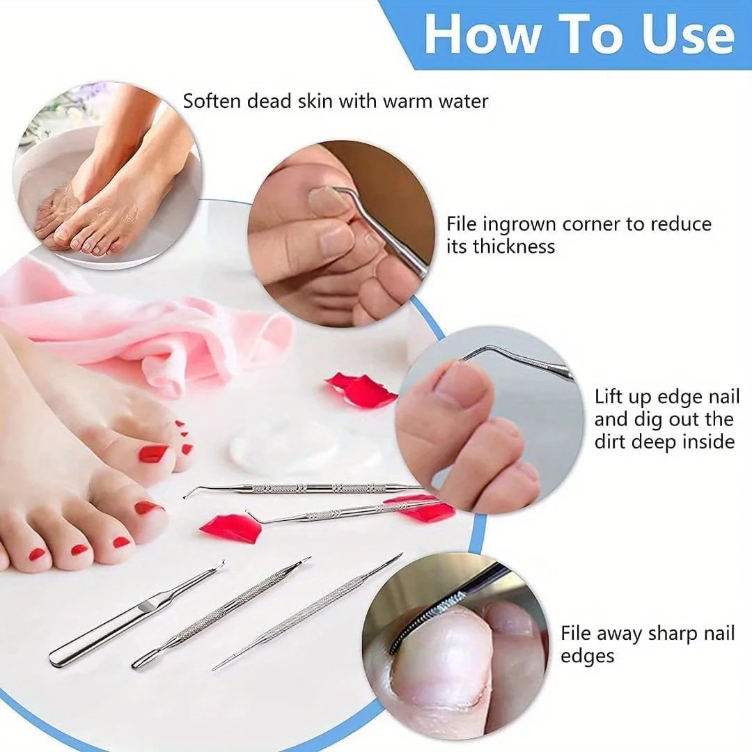 Professionele nagelriemverwijderaar nagelriemverwijderaarset, roestvrijstalen nagelriemtrimmergereedschap, pedicure- en manicure-nagelsets, vakantiecadeau