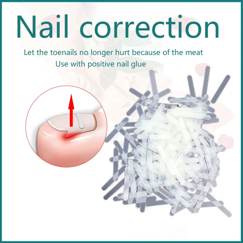 10pcs Ingrown Toenail Correction Tool Toe Nail Treatment Elastic Patch Sticker