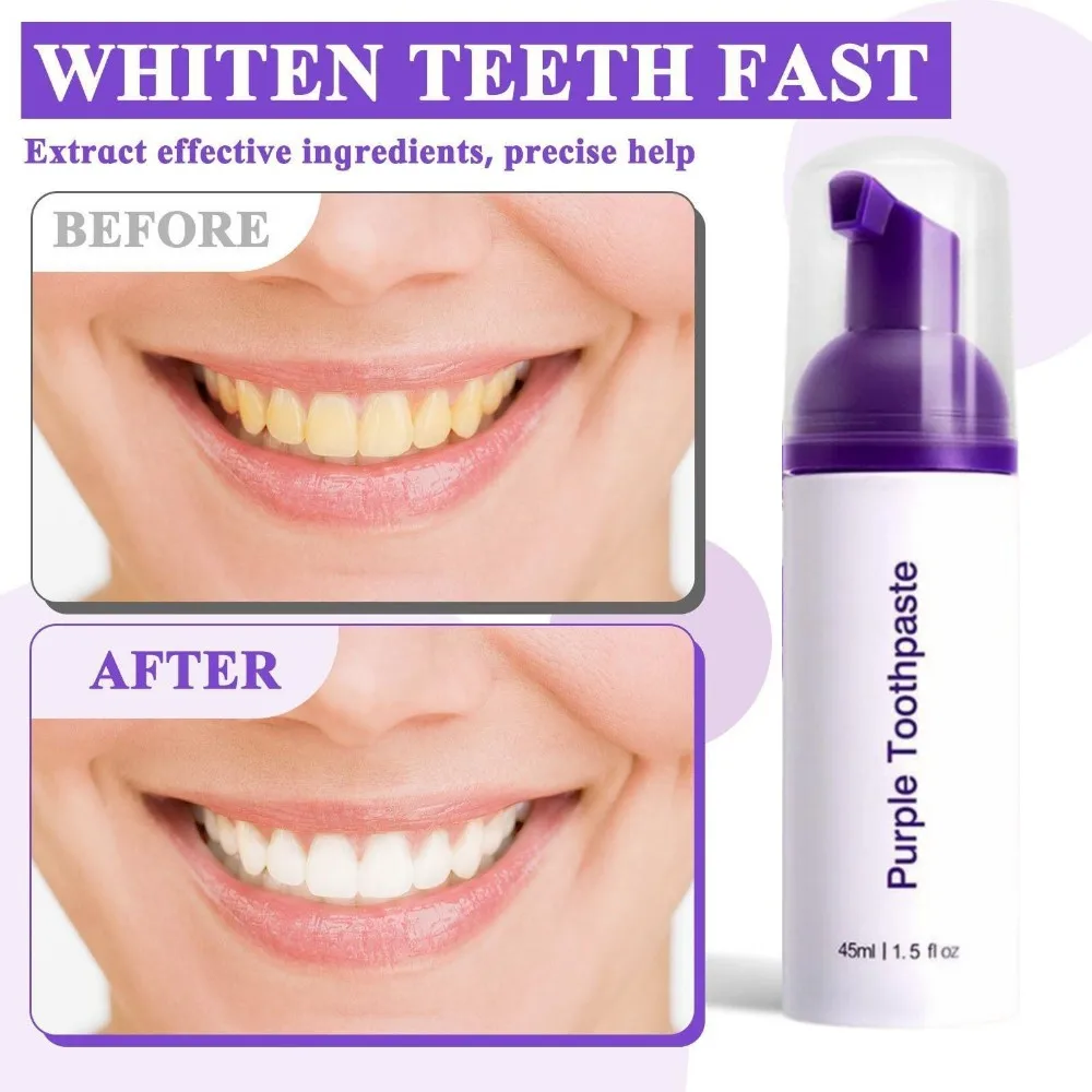 Purple Whitening Toothpaste Foam Color Corrector Foam Remove Stains Brighten Teeth Fresh Breath Multi‑Effect Oral Care Mousse