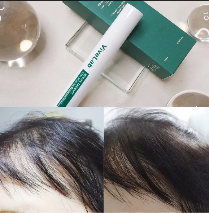15ml Stronger Shinier Healthier Fuller Hair Original Hair Repair Ball Applicator ViveLab Revive Therapy Hair Scalp Brow Ampoule