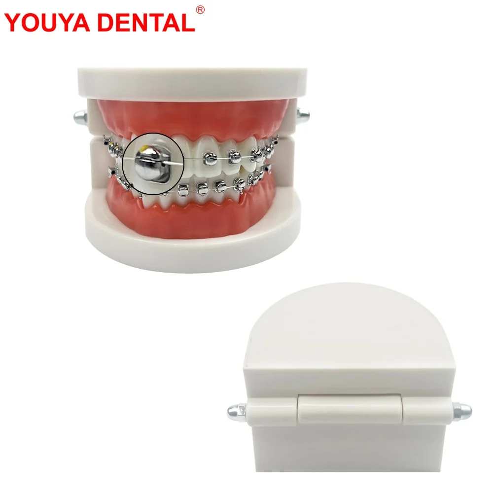 

Full Self-Locking Dental Orthodontic Treatment Teeth Model With Sphericity Metal Brackets Dental Models For Patient Education