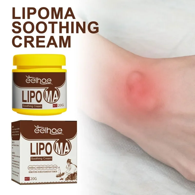 Lipoma ครีมใต้ผิวหนังก้อน Remover Treatment ยา Liquid ใช้กับผิวบวมเซลลูไลท์ Fibroma มวลไขมันพลาสเตอร์