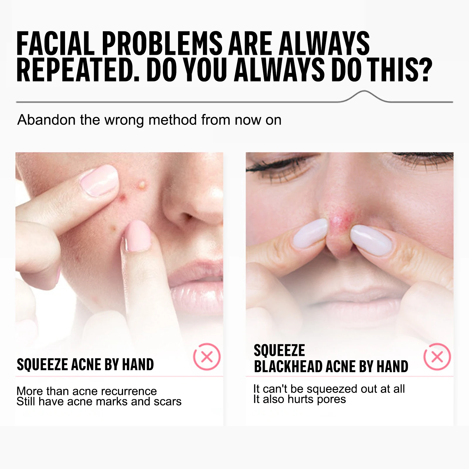 Kit di strumenti per la rimozione di punti neri in acciaio inossidabile per il viso Set di pinzette per estrattore di comedoni preciso Strumenti professionali per la pulizia dei pori