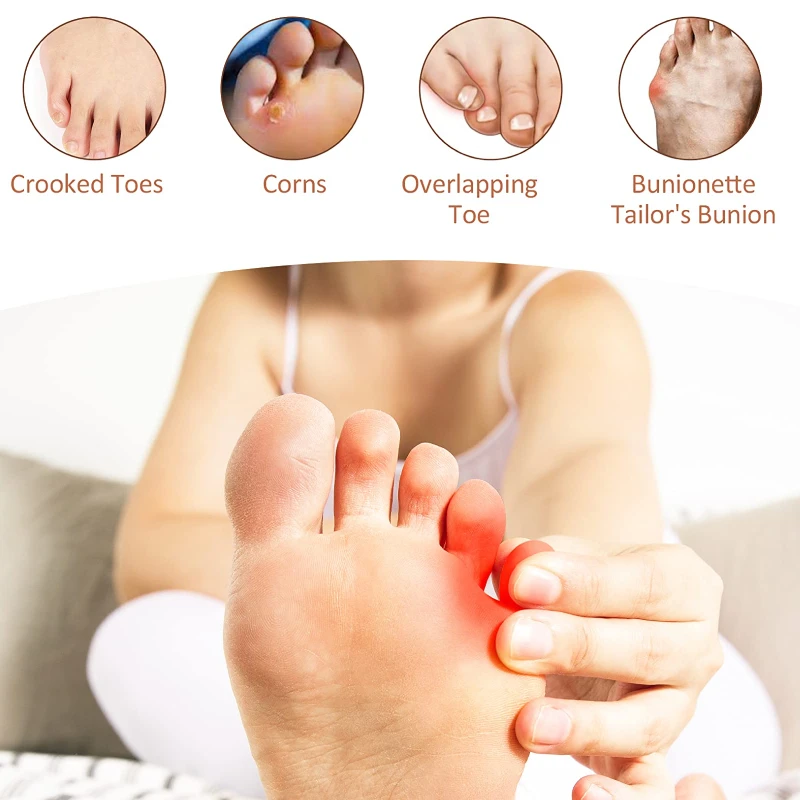 2pieces = 1pair Anti-Slip 발가락 스트랩 풋 케어 Hallux Valgus 젤 작은 발가락 쿠션 페디큐어 도구 Professional Bunion Corrector