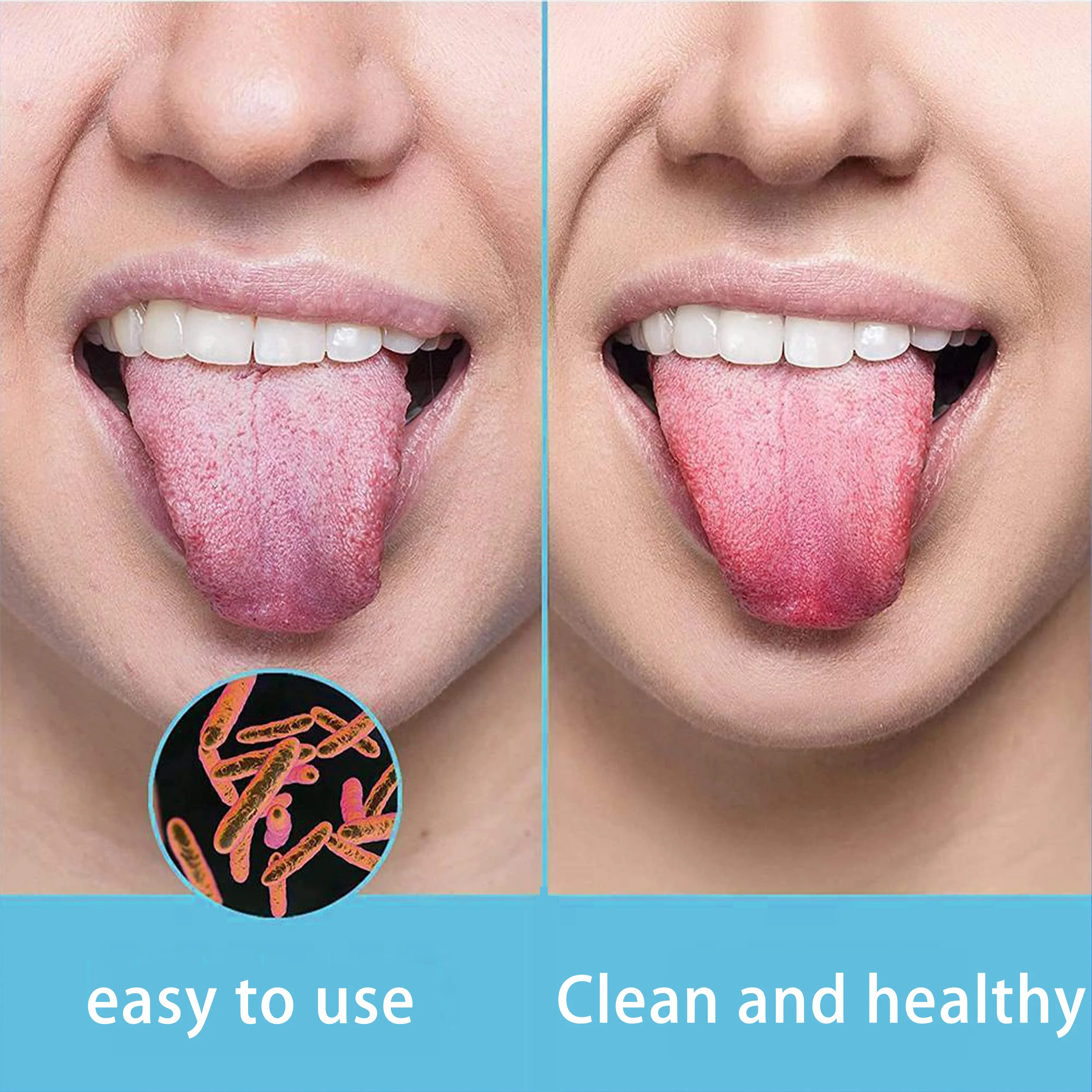 Thumbnail 4 - #51 Latest Tongue Scrapers Offers