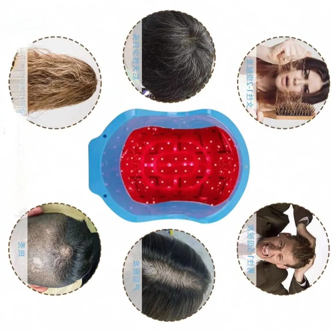

80-LED Hair Growth Helmet: Clinically Proven to Stimulate Follicles Advanced 650nm Boost Hair Regrowth with Light Therapy