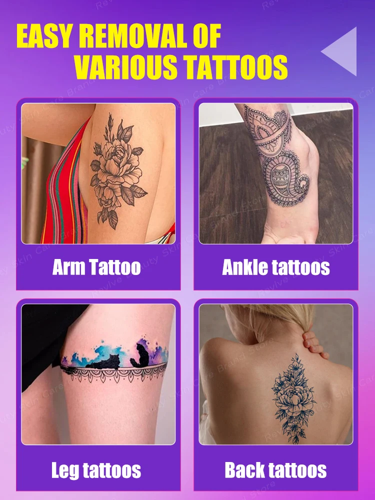 ᵀᵃᵗᵗᵒᵒ ᴿᵉᵐᵒᵛᵃˡ ᔆᵖʳᵃʸ ᔆᵘⁱᵗᵃᵇˡᵉ ᶠᵒʳ ᴸᵃʳᵍᵉ ᵃⁿᵈ ᔆᵐᵃˡˡ ᵀᵃᵗᵗᵒᵒˢ⸴ ᴱᶠᶠᵉᶜᵗⁱᵛᵉ ⁱⁿ ᴿᵉᵐᵒᵛⁱⁿᵍ ᴾᵉʳᵐᵃⁿᵉⁿᵗ ᵀᵃᵗᵗᵒᵒˢ