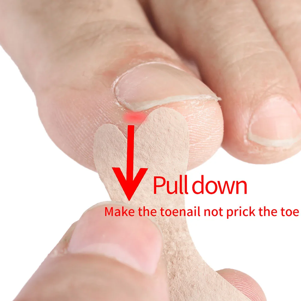 

36 Pcs Toenail Healing Decals Ingrown Patch Tape Recover Sticker Stickers