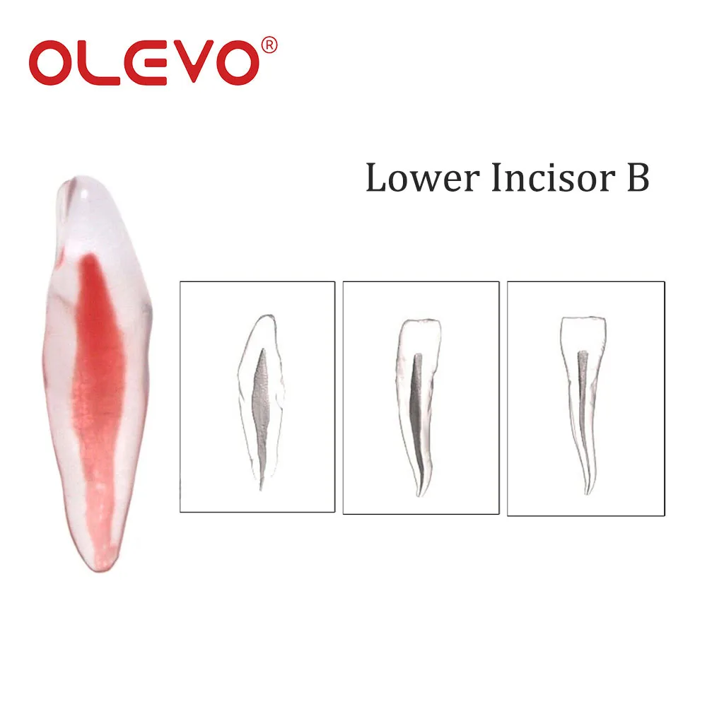 OLEVO 1 Pcs Dental RCT Endo Training Teeth Root Canal Model 3D Curved Premolar Cuspid Teeth Models 12 Sizes Endodontic Teaching