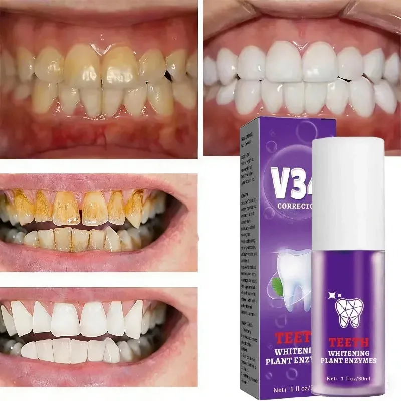 Korean Teeth Cleansing Whitening V34 Toothpaste: Stain & Yellow Removal, Fresh Breath, Deep Clean & Whitening, Oral Care