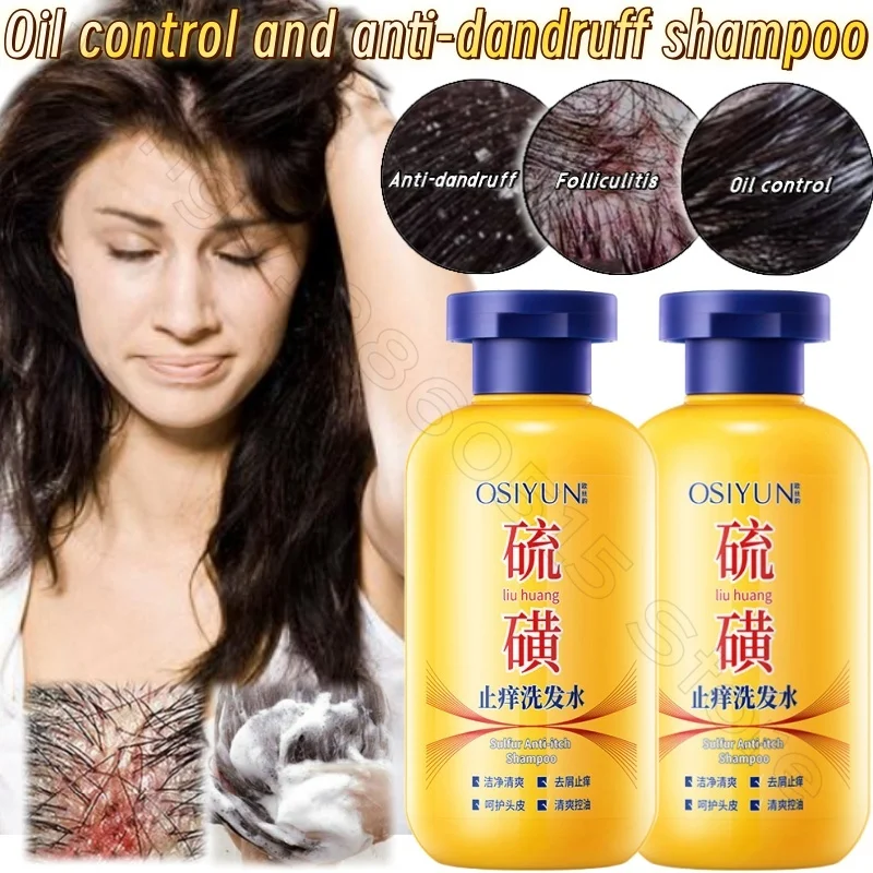 Sulfur Anti-itting Shampoo 200g Deep Cleaning Oil-control Fluffy Anti-dandruff Anti-itting and Mite Removal Shampoo