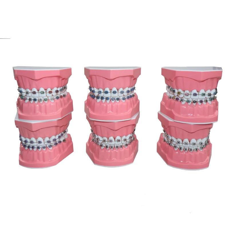 28 piece set of orthodontic dental models with metal brackets and archwire oral demonstration tools