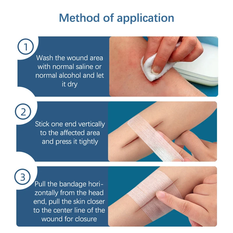 2/3/5Strip Outdoor Wound Adhesive Tape Disposable First Aid Wound Suture Patch Tie Wound Closure Patch Hemostatic Patch Band Aid