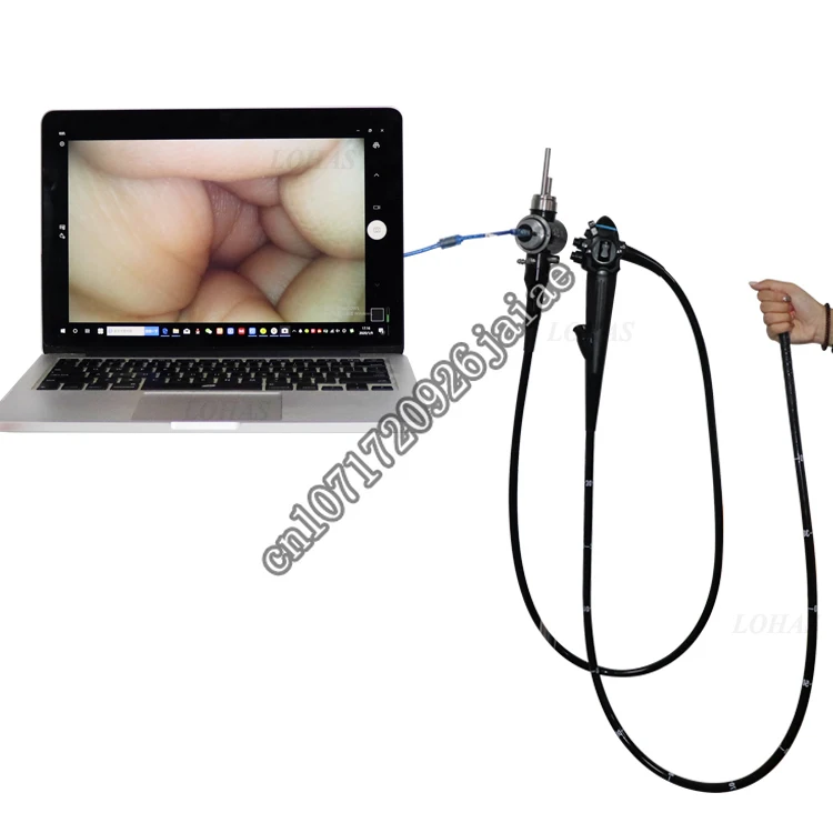 Système d'endoscope médical LHEMV4 USB, coloscopie, source de lumière LED intégrée, coloscope vidéo électronique haute résolution