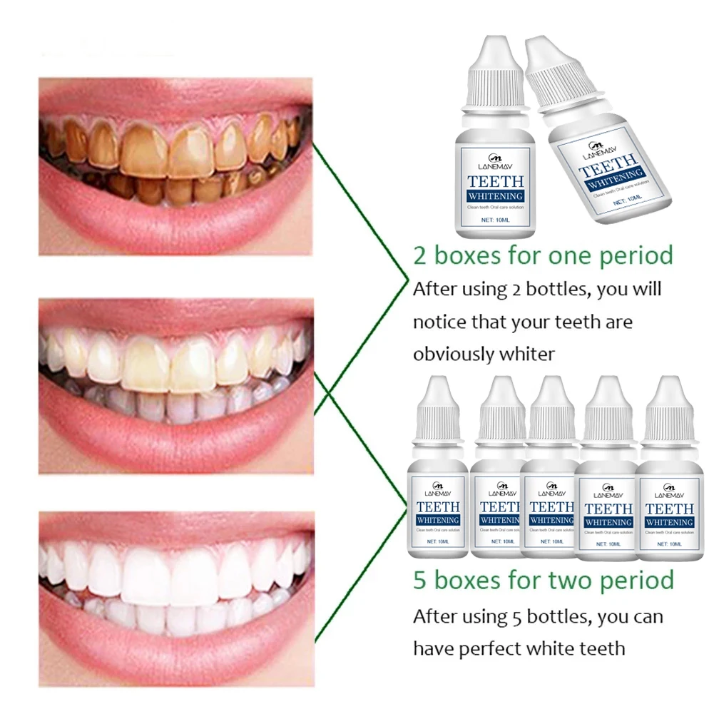 Teeth Whitening Essence Serum Oral Hygiene Care Cleaner Whiten Teeth Whitener Remove Plaque Stains Fresh Breath Dental Tools