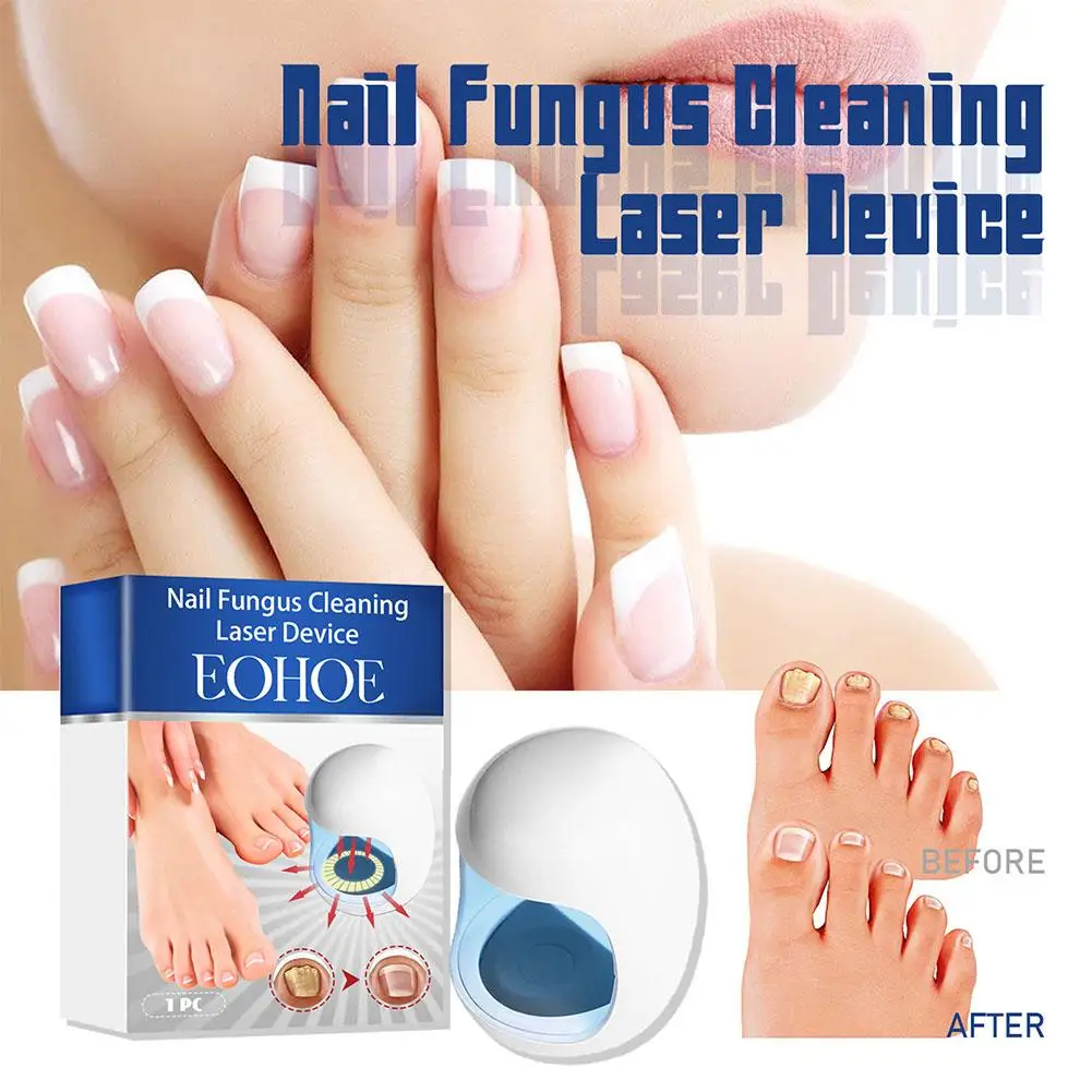 Nail Fungus Laser Treatment Device Fungal Treatment Feet Care Essence Anti Infection Toenail Fingernail Treatment Care Tools