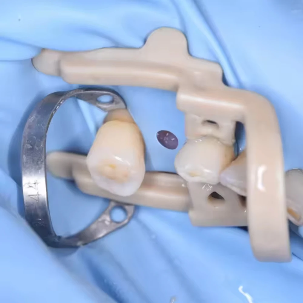 5PCS Stainless Steel Rubber Dam Clamps for Endo Restorative Ortho Procedures Reusable Lab Clinical Use Sizes B1 to B6