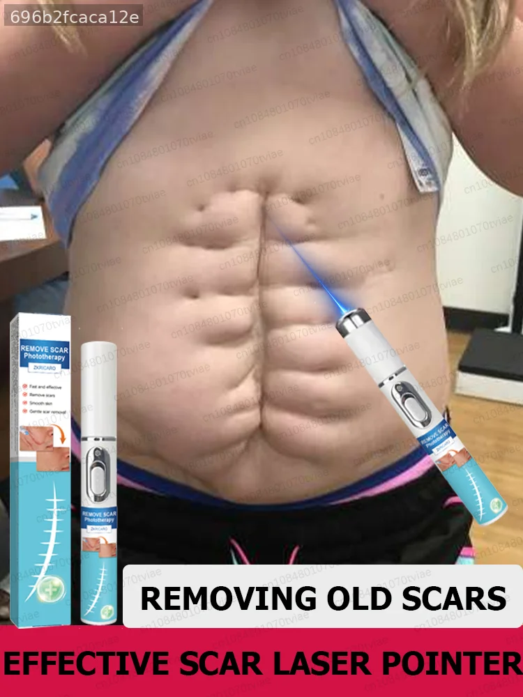 Disappearance is not a dream; restore smooth, flawless skin.scars  Scar Care