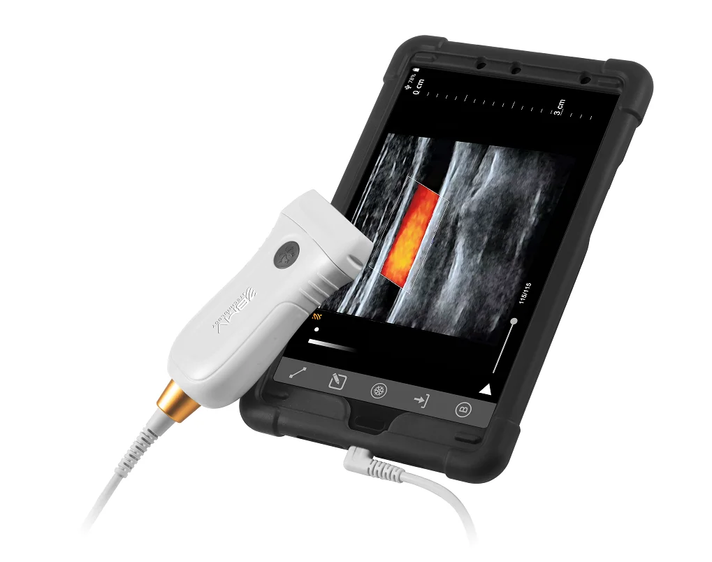 USB Ultrasound Medical Scans Convex Linear Ultrasound Probe Intelligent B/W Color Doppler App Based POC Portable Ultrasound