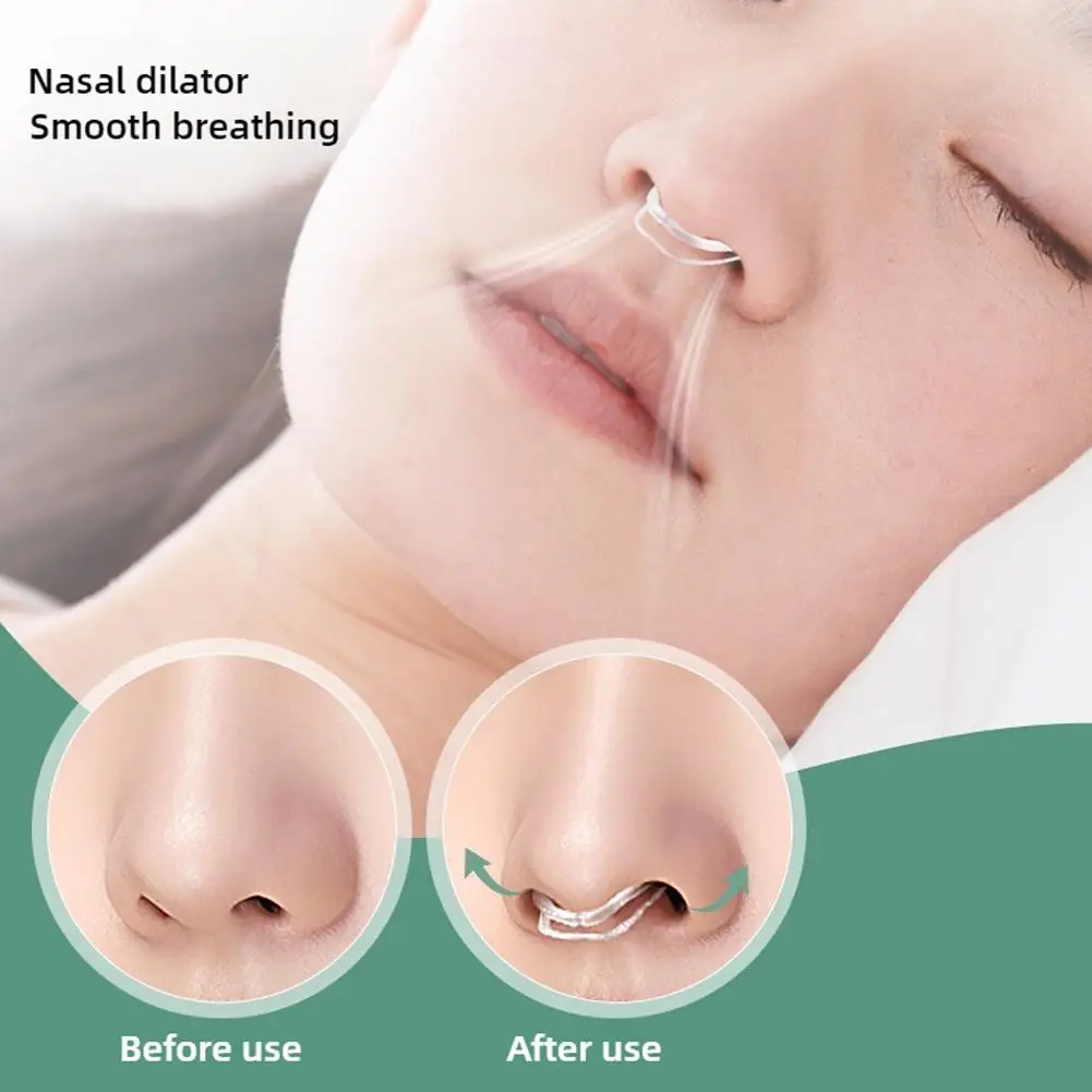 Nose Clip Anti Snoring Device Soft Rebound Night Sleep Anti Mouth Opening Prevent Snoring Comfortable Physical Closure Product