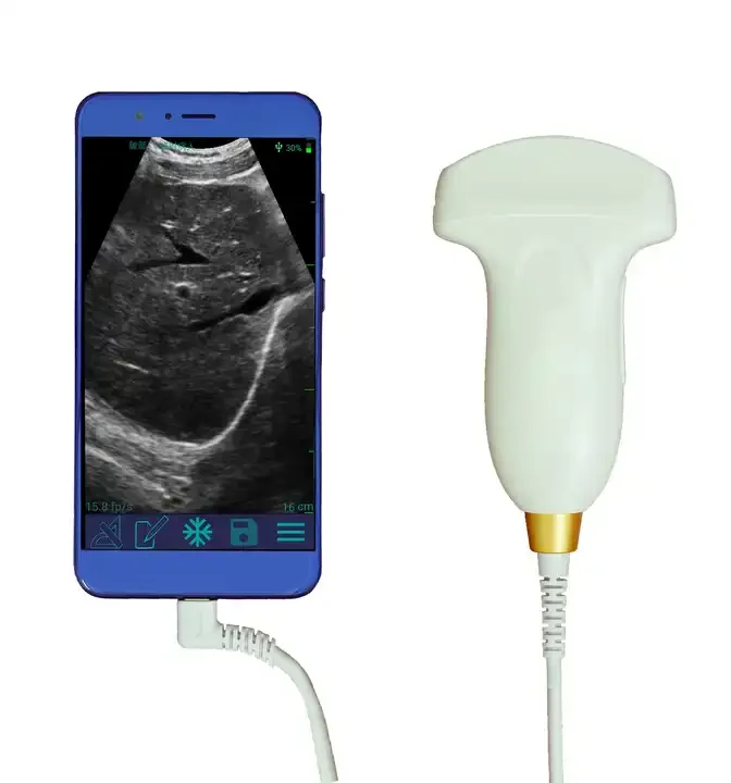 Sonde de scanner convexe linéaire USB intelligente médicale