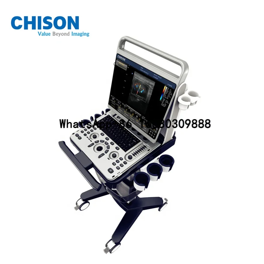 Hot Selling CHISON EBit 30 Portable Ultrasound Machine With Eco-friendly Design for Gallbladder stone Abdomen Fetal and MSK