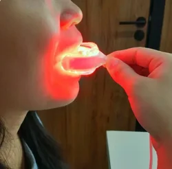 Red light therapy whitens teeth removes plaque stains teeth whitener oral hygiene