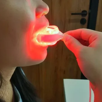 Red light therapy whitens teeth removes plaque stains teeth whitener oral hygiene