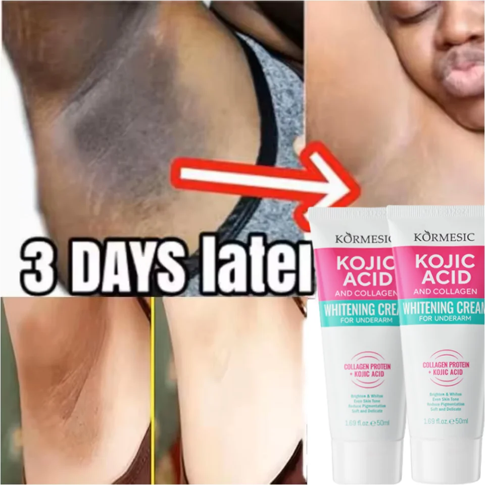 Crema blanqueadora para axilas y cuerpo, 50g, partes privadas, blanqueamiento, glaseado, glúteos, rodilla, ilumina la parte interna del muslo, íntimo, oscuro, elimina la melanina