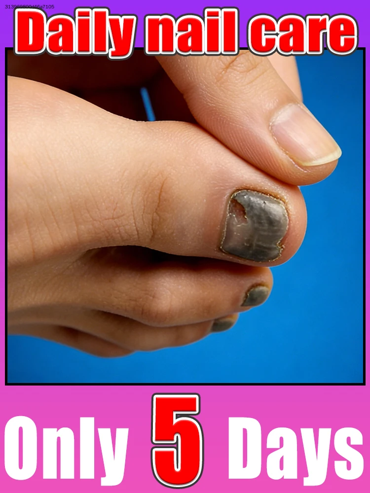 

Bʀᴇᴀᴋ ᴀᴡᴀʏ ғʀᴏᴍ ᴅʀʏ ᴄʜᴀᴘᴘᴇᴅ ᴄᴜᴛɪᴄʟᴇs, ғɪɴɢᴇʀᴛɪᴘs sᴛᴀʏ ᴍᴏɪsᴛ ɴᴏᴜʀɪsʜᴇᴅ